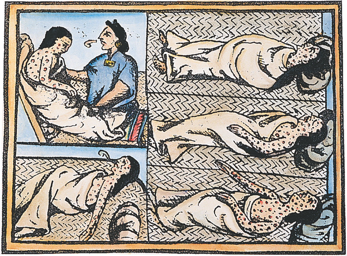 Drawings show an Aztec man covered with red smallpox sores.