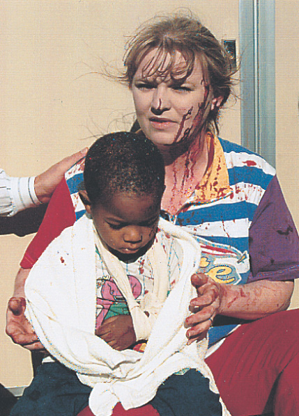 photo: a bloodied woman holds a boy with his arm in a sling.